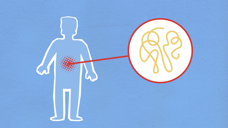 The Role of Inflammation in Disease: A Functional Medicine Perspective